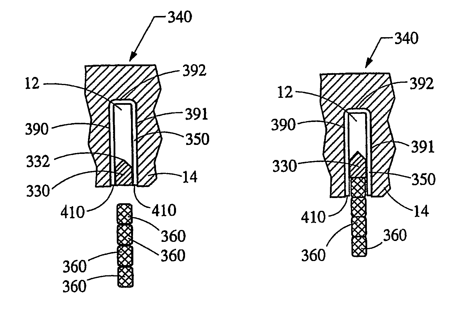 Method for forming a stator core