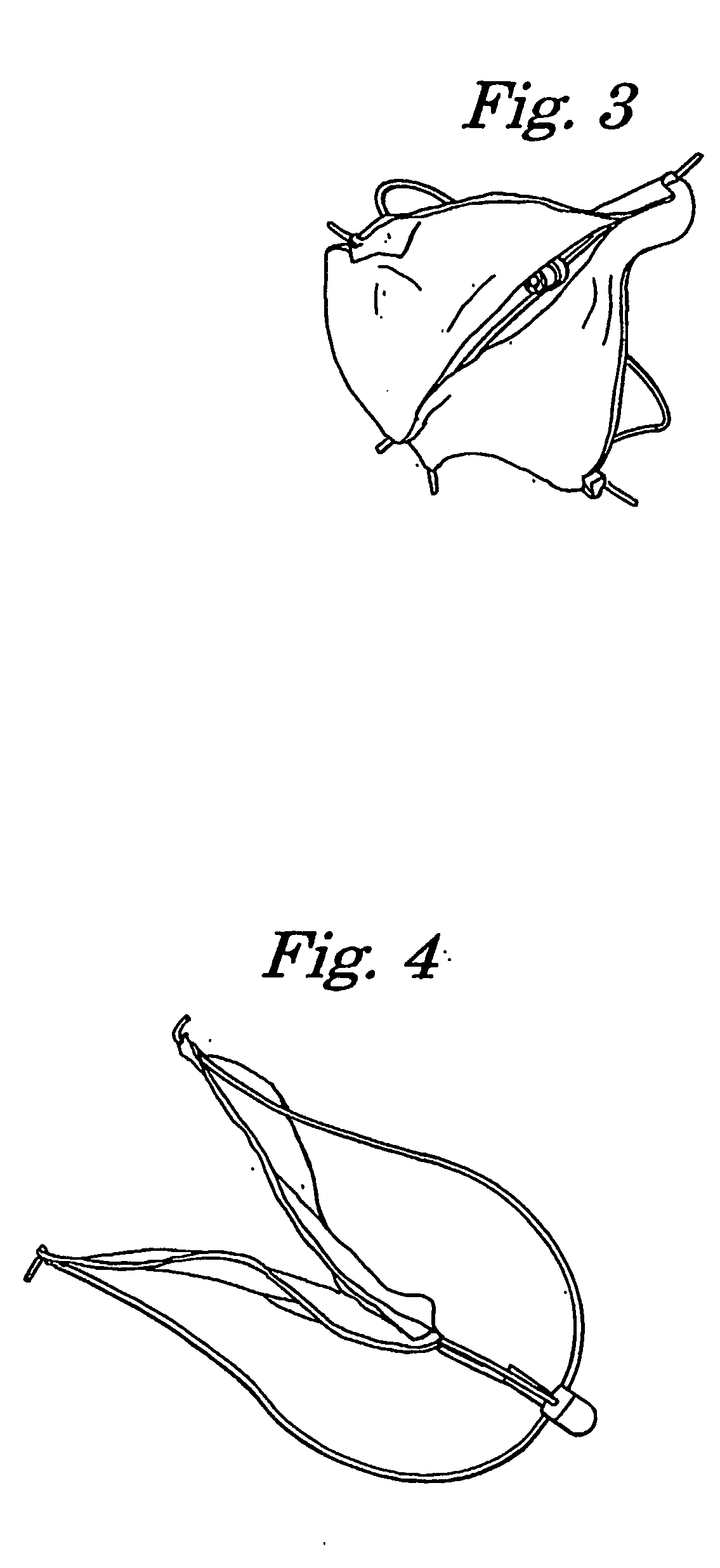 Venous bi-valve