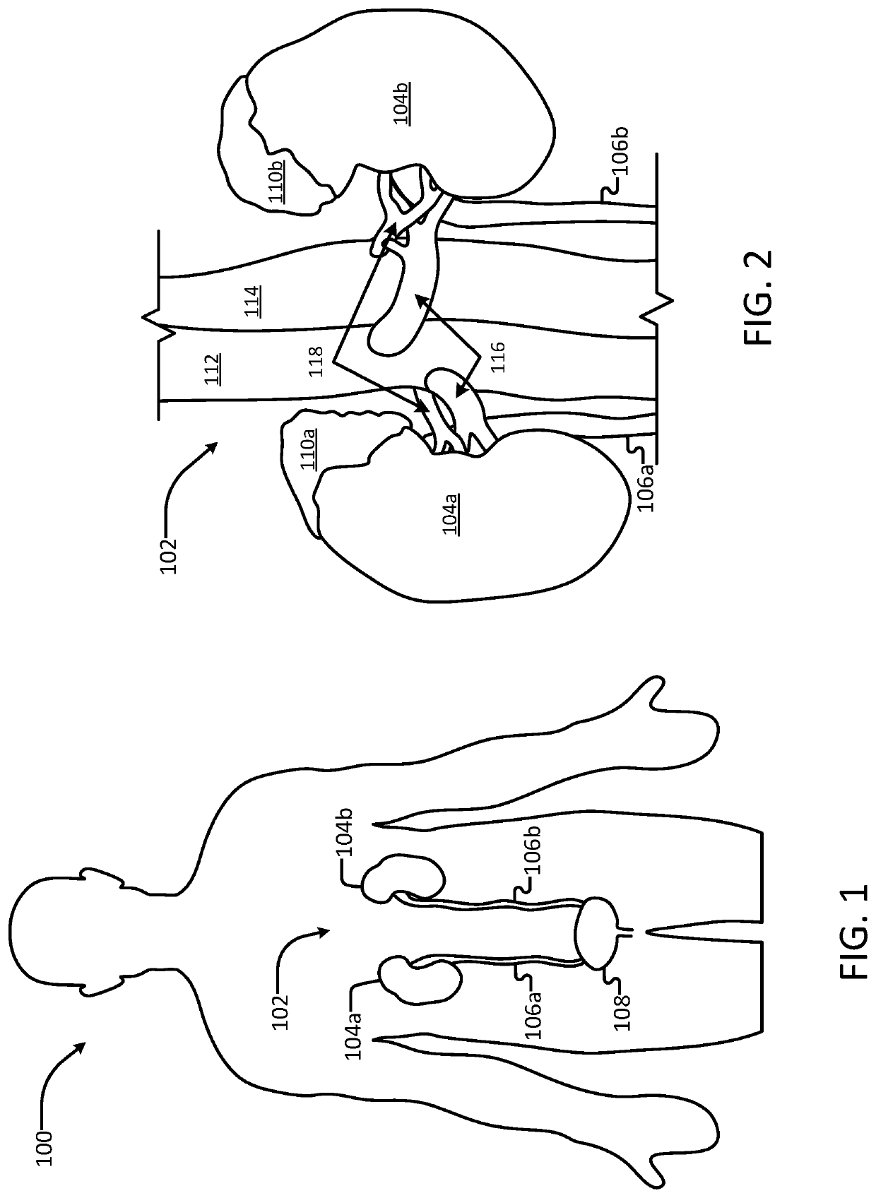 Systems and methods for electroporation