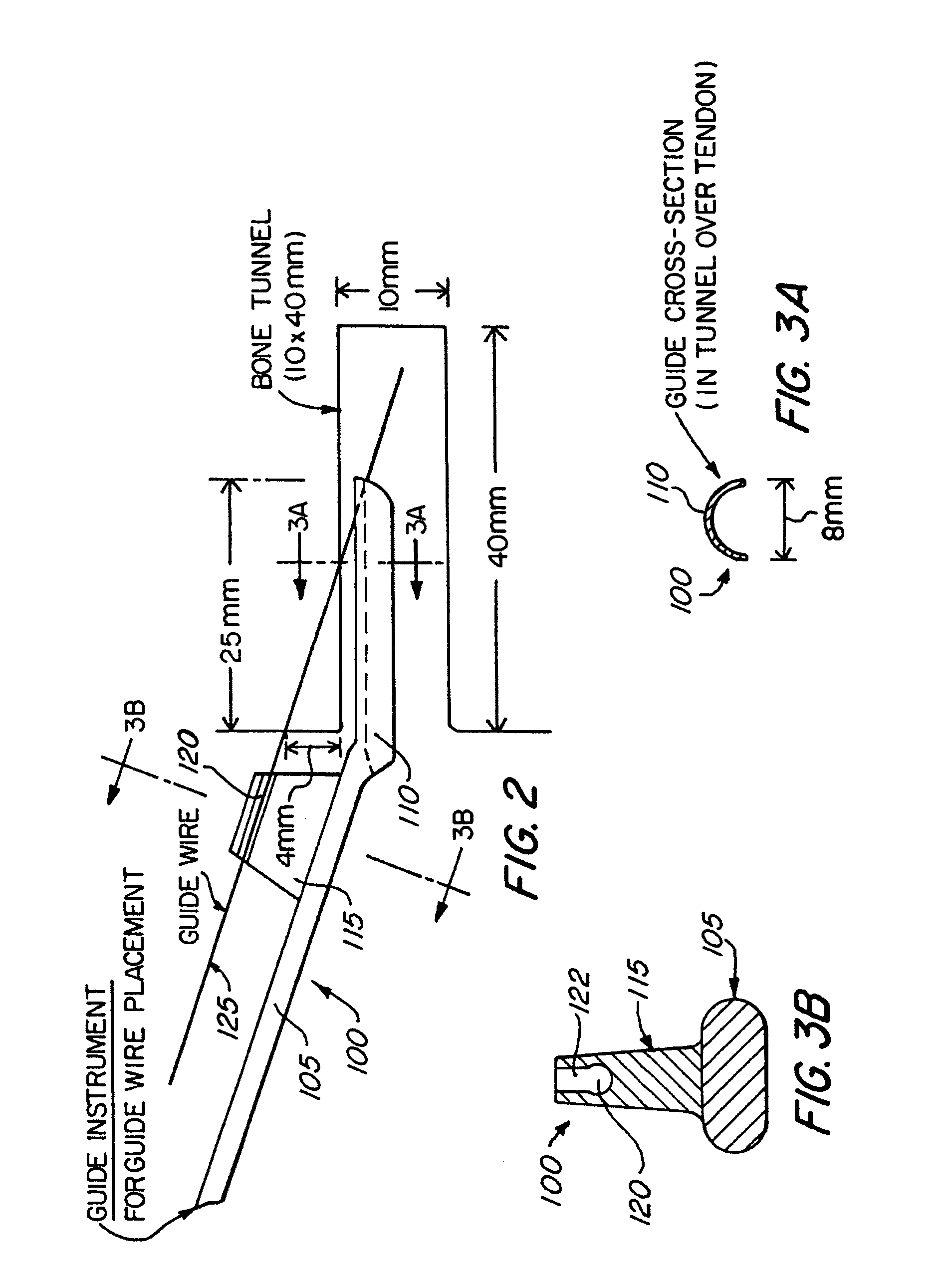 Method and apparatus for reconstructing a ligament