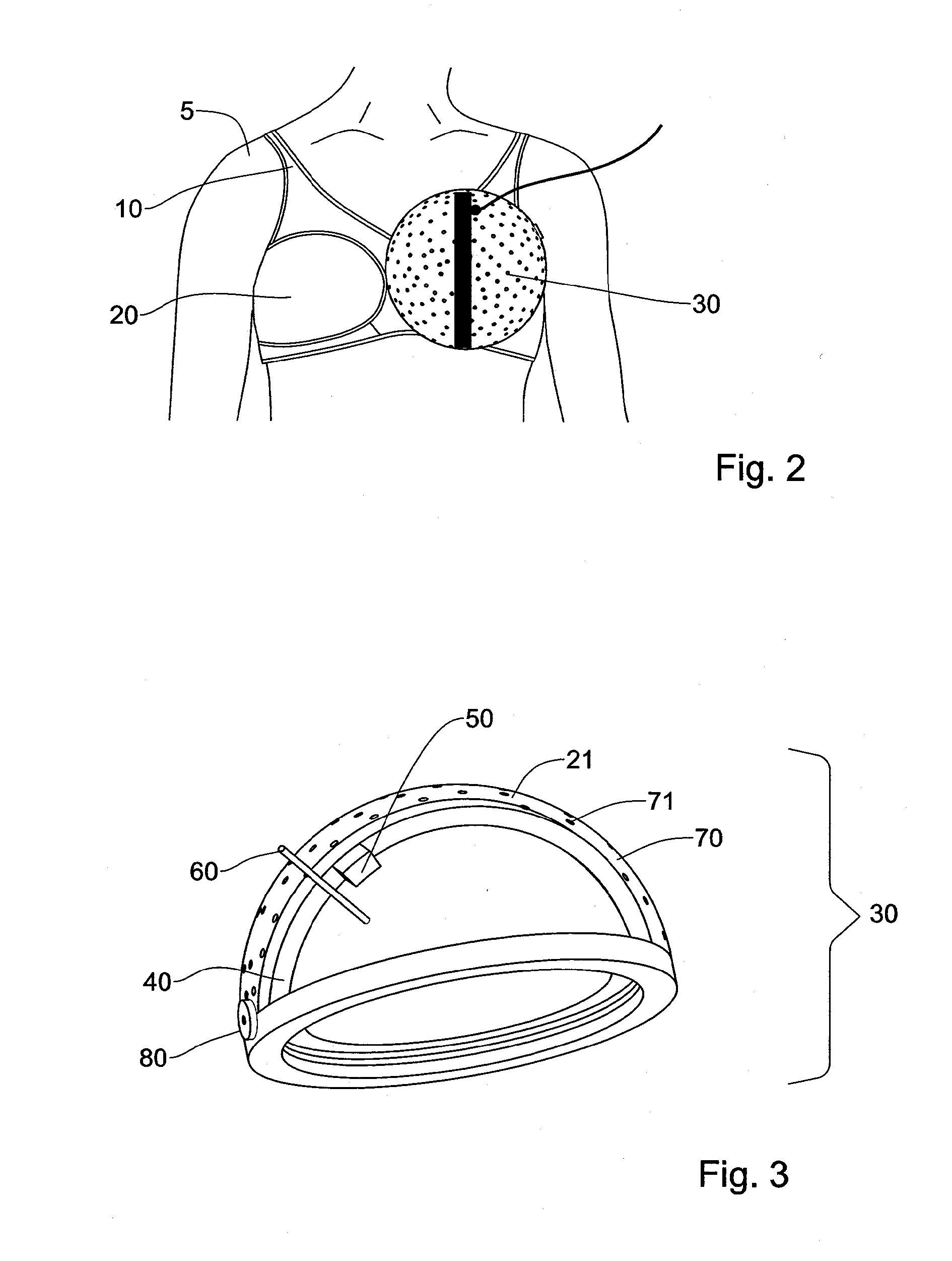 System and method for ultrasonic examination of the breast