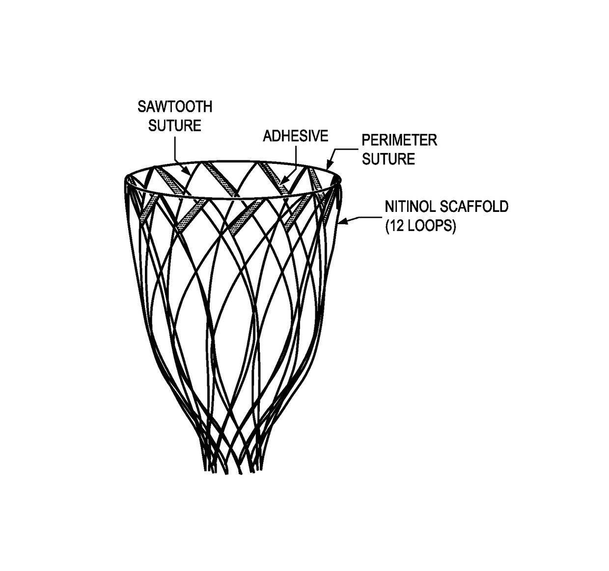 Diastolic recoil method and device for treatment of cardiac pathologies