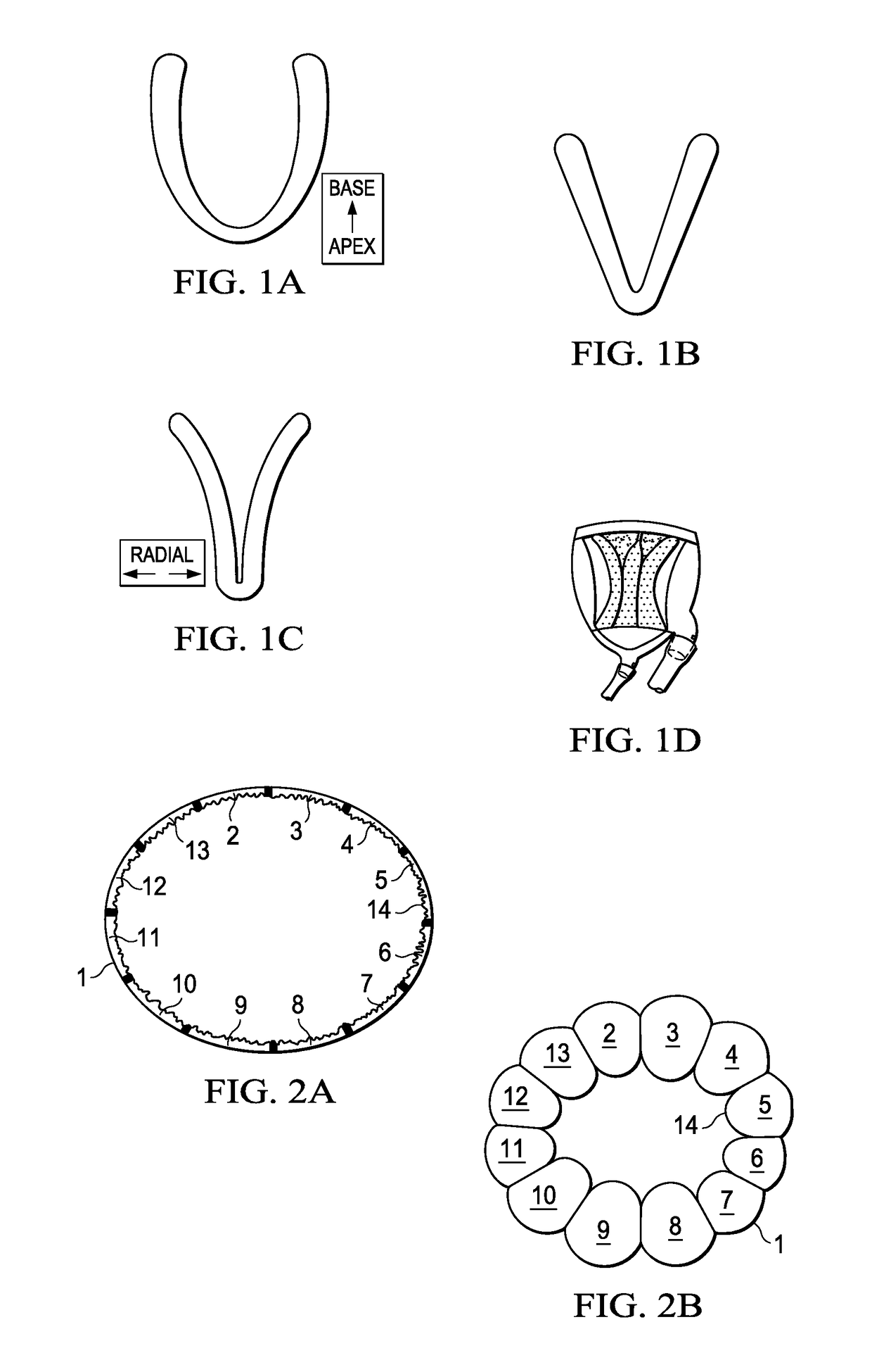 Diastolic recoil method and device for treatment of cardiac pathologies