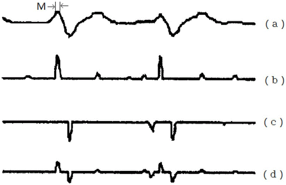 Method and device for detecting p-wave and t-wave in electrocardiogram signal