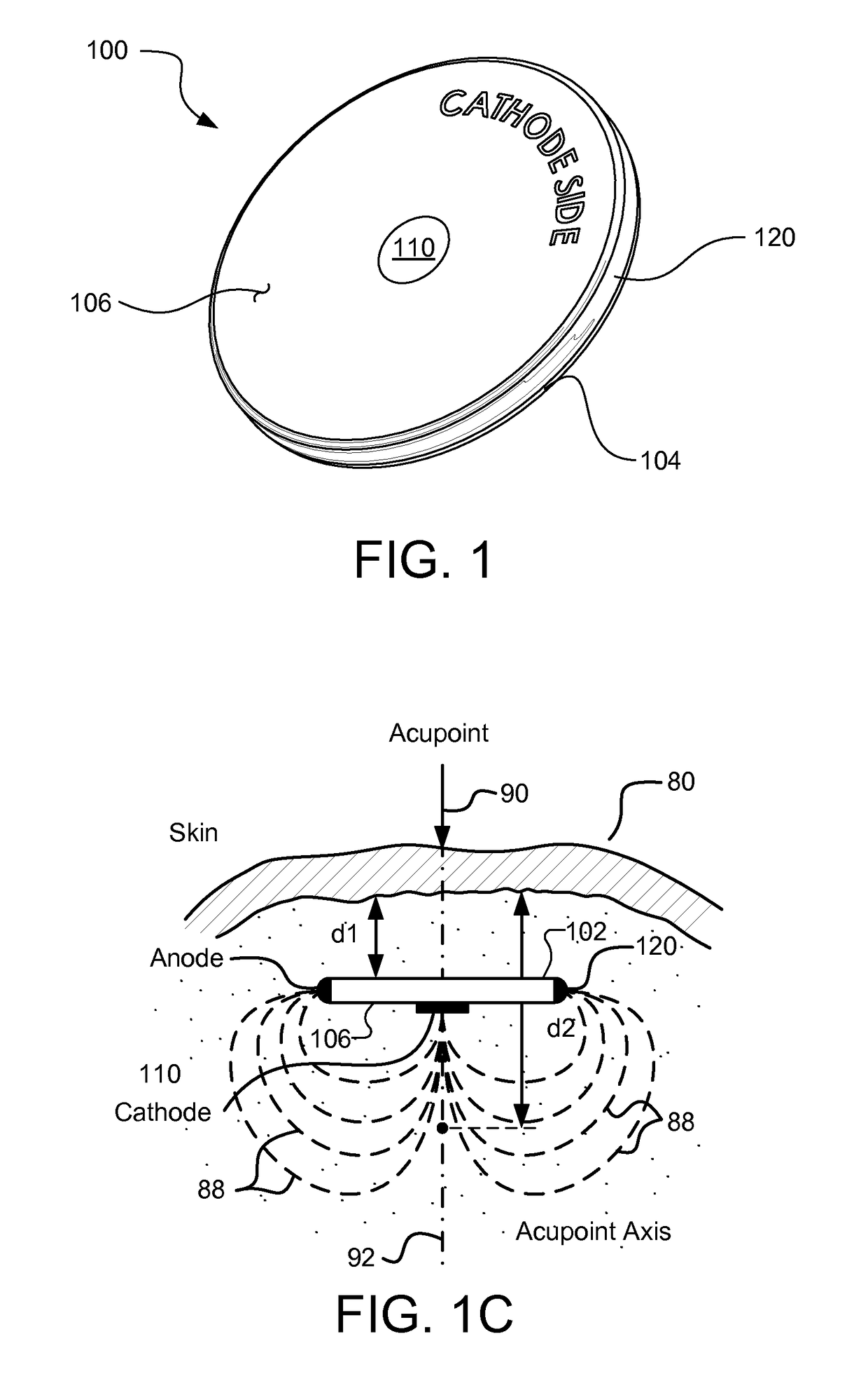 Methods and systems for treating a chronic low back pain condition using an implantable electroacupuncture device