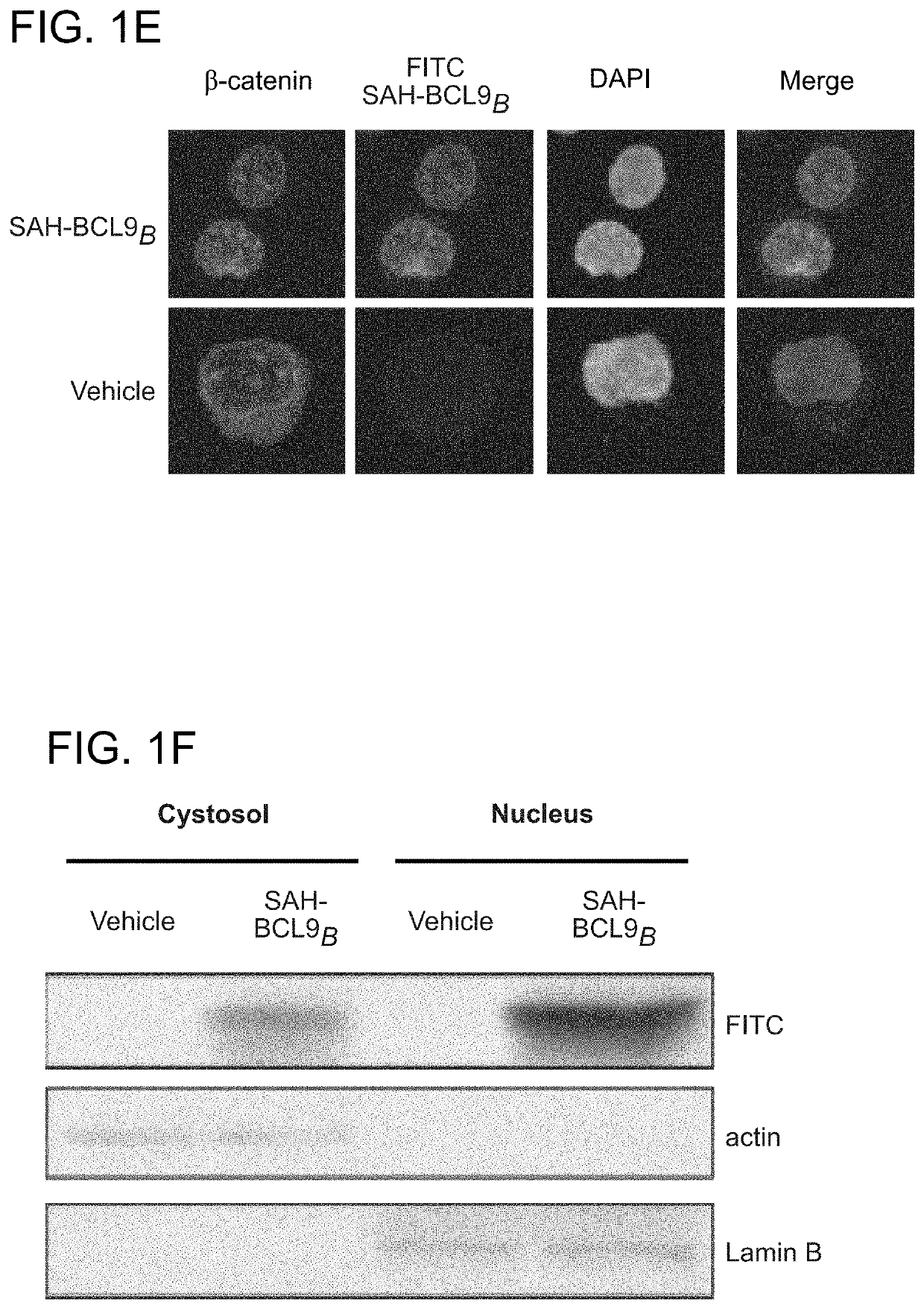 Targeting deregulated Wnt signaling in cancer using stabilized alpha-helices of BCL-9