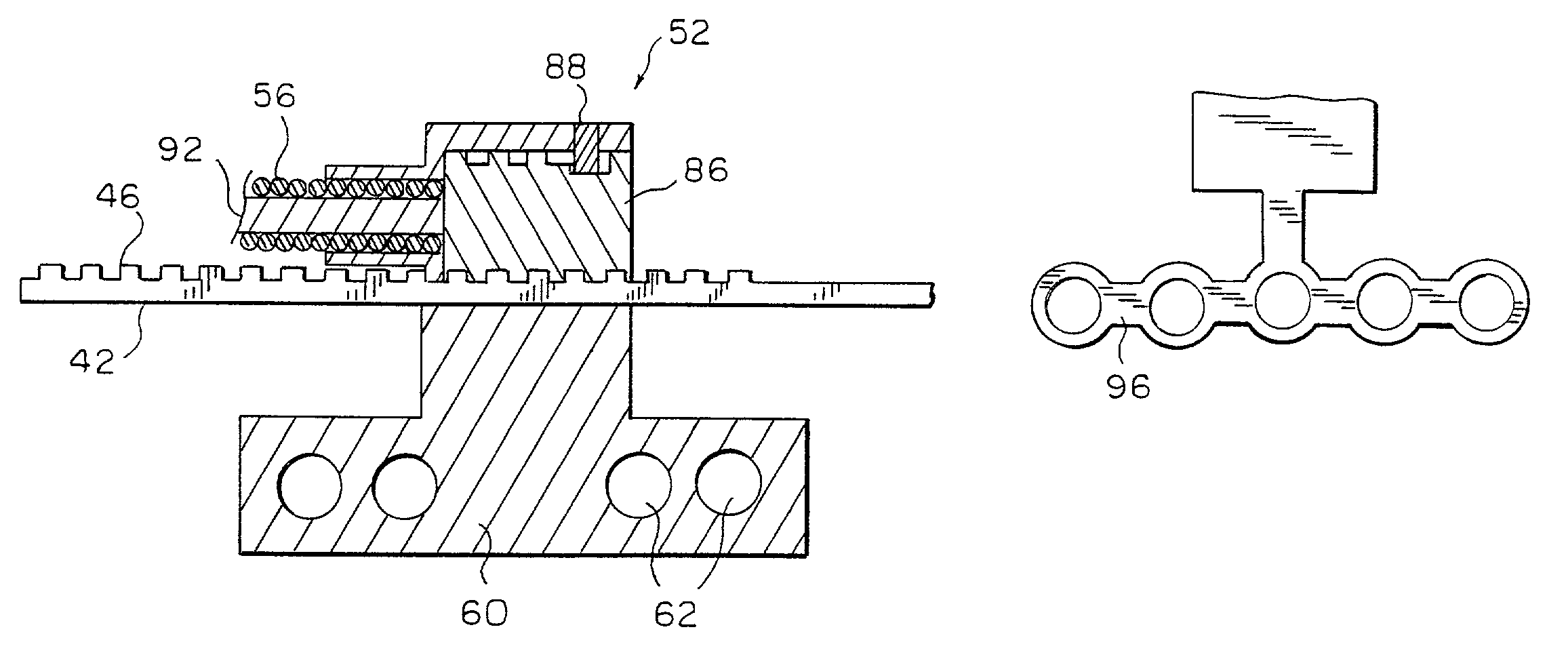 Multi-directional internal distraction osteogenesis device