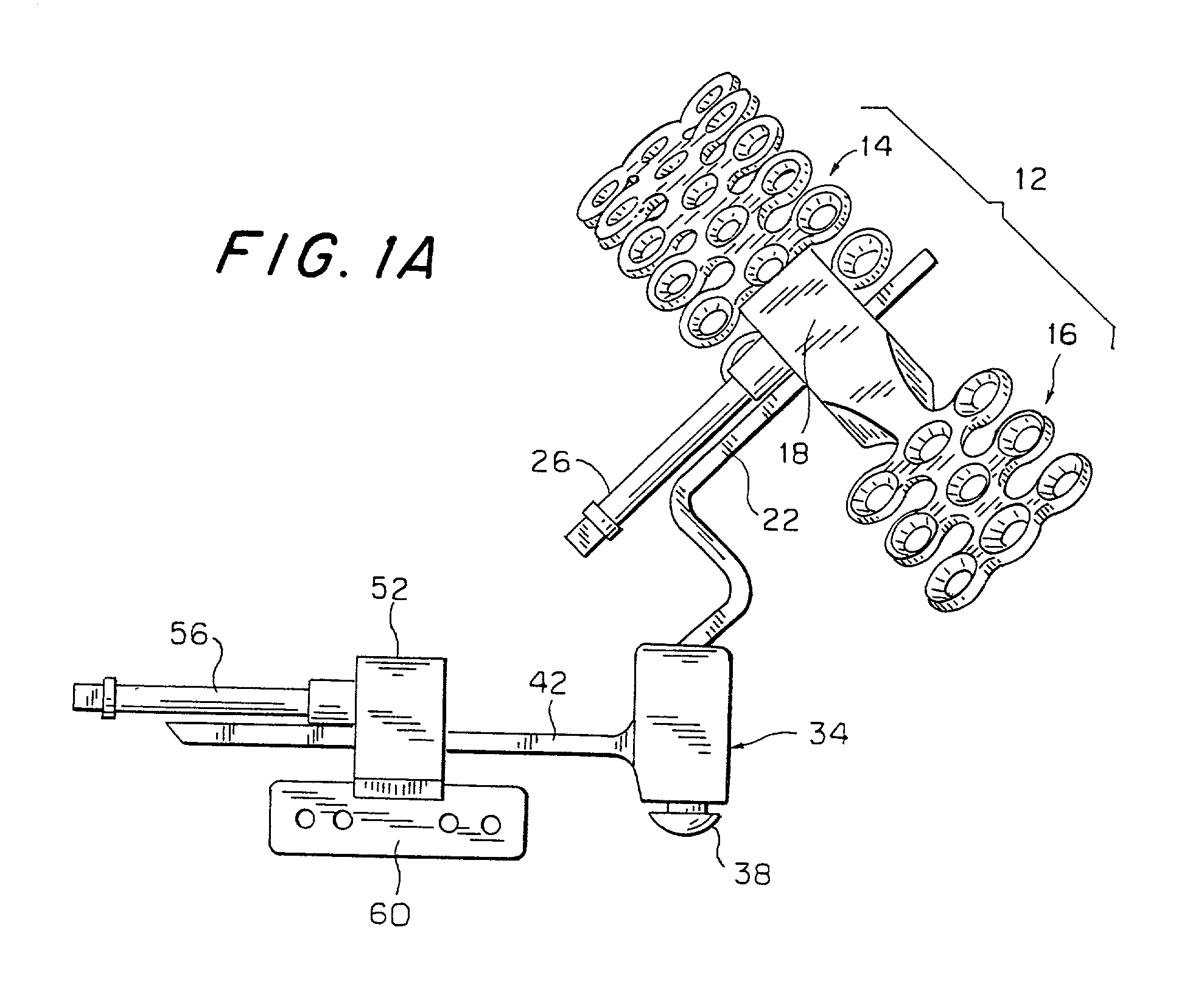 Multi-directional internal distraction osteogenesis device