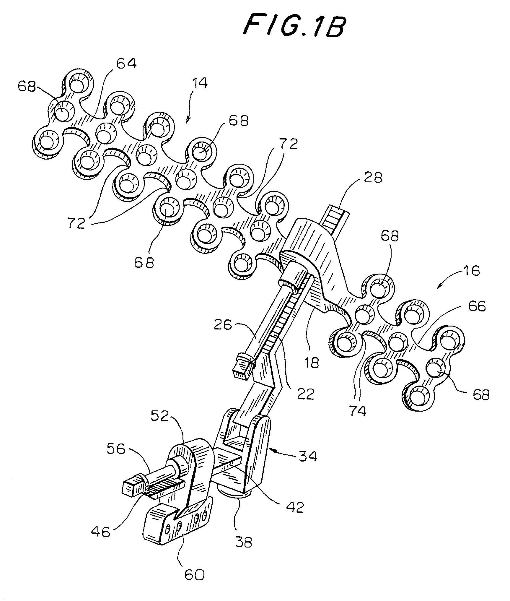 Multi-directional internal distraction osteogenesis device