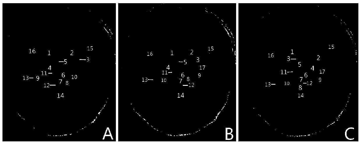 A three-dimensional modeling method for sectional image anatomy of human striatum and hippocampal formation