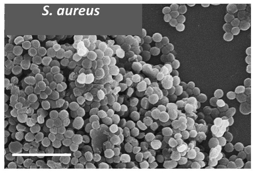 A kind of polypeptide antibiotic and its preparation method and application