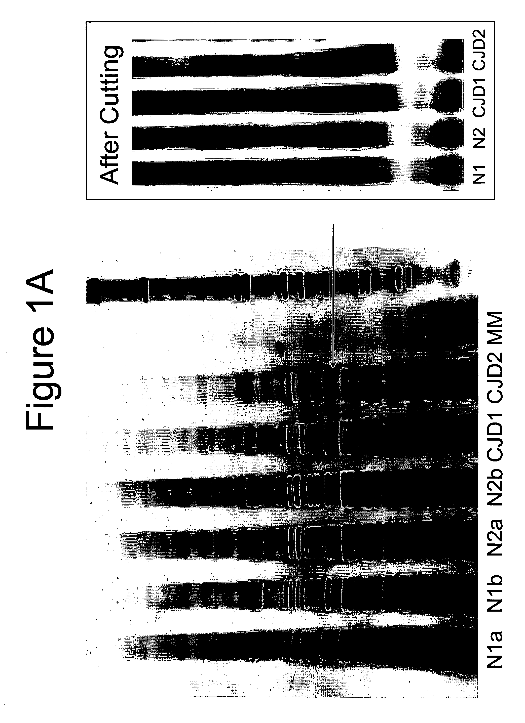 Detection of nucleic acids to assess risk for Creutzfeldt-Jakob disease