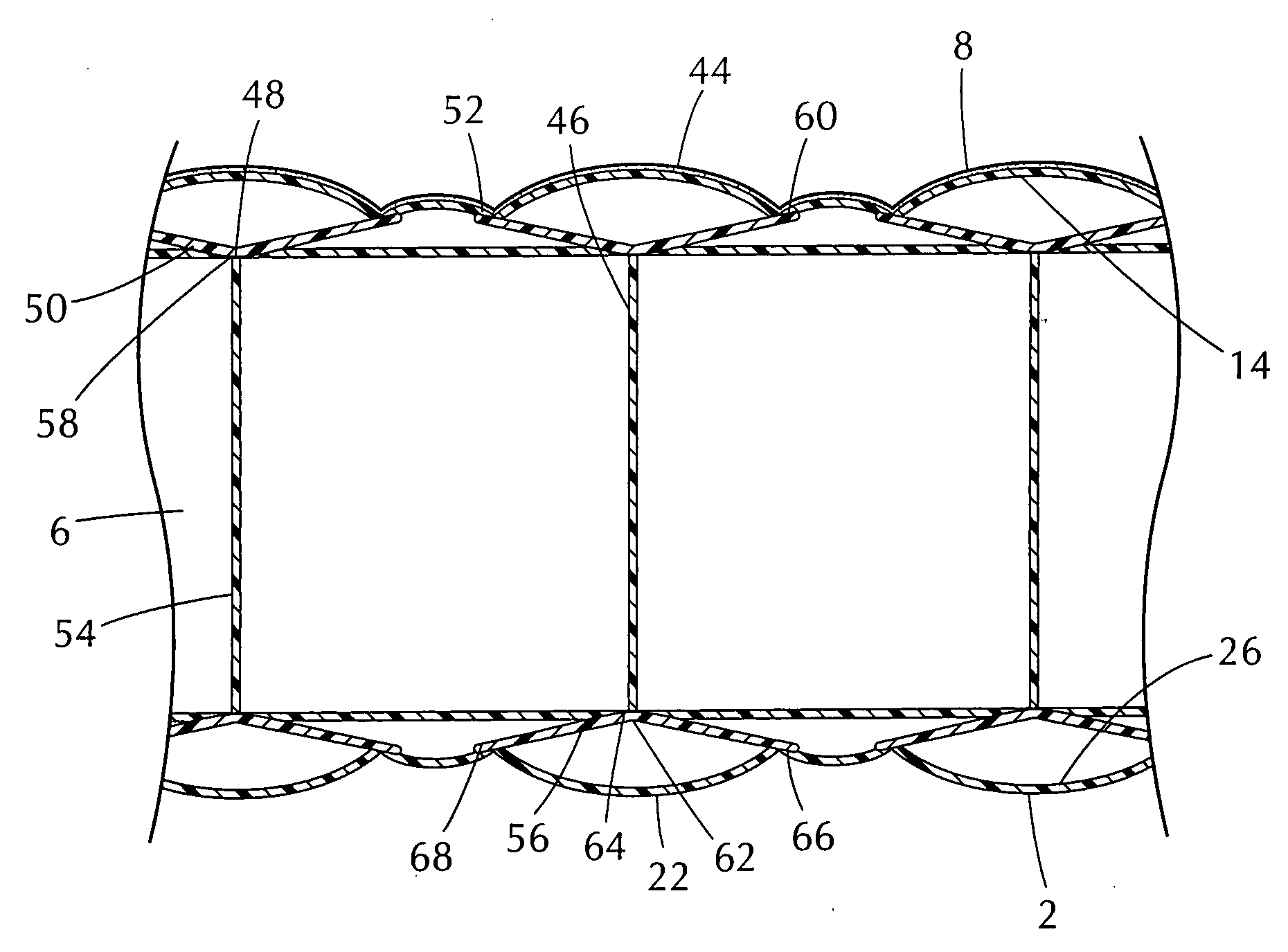 Inflatable mattress assembly