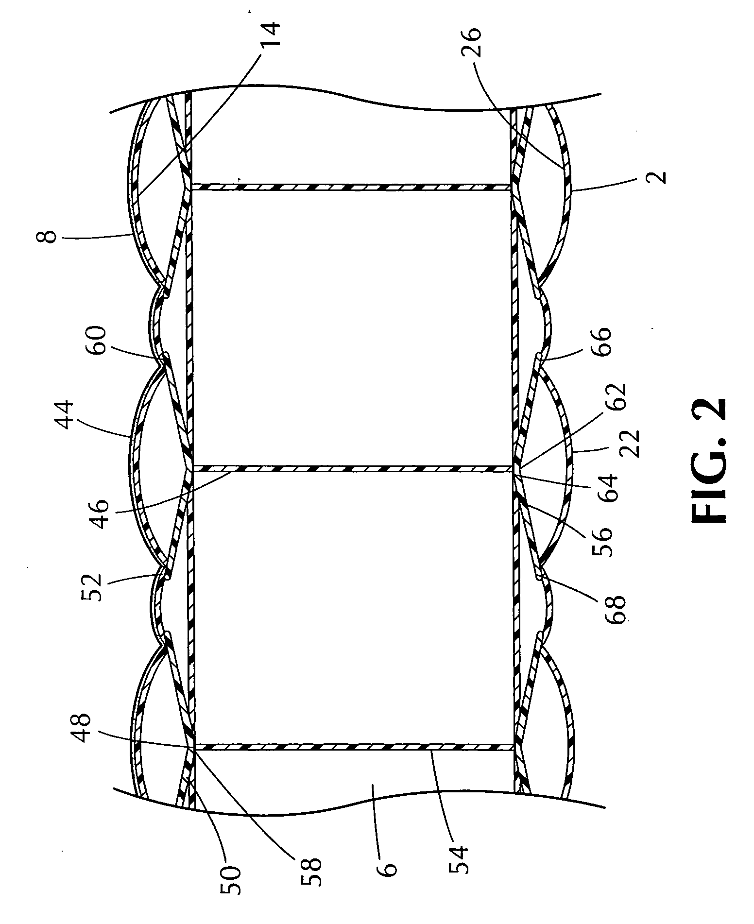 Inflatable mattress assembly