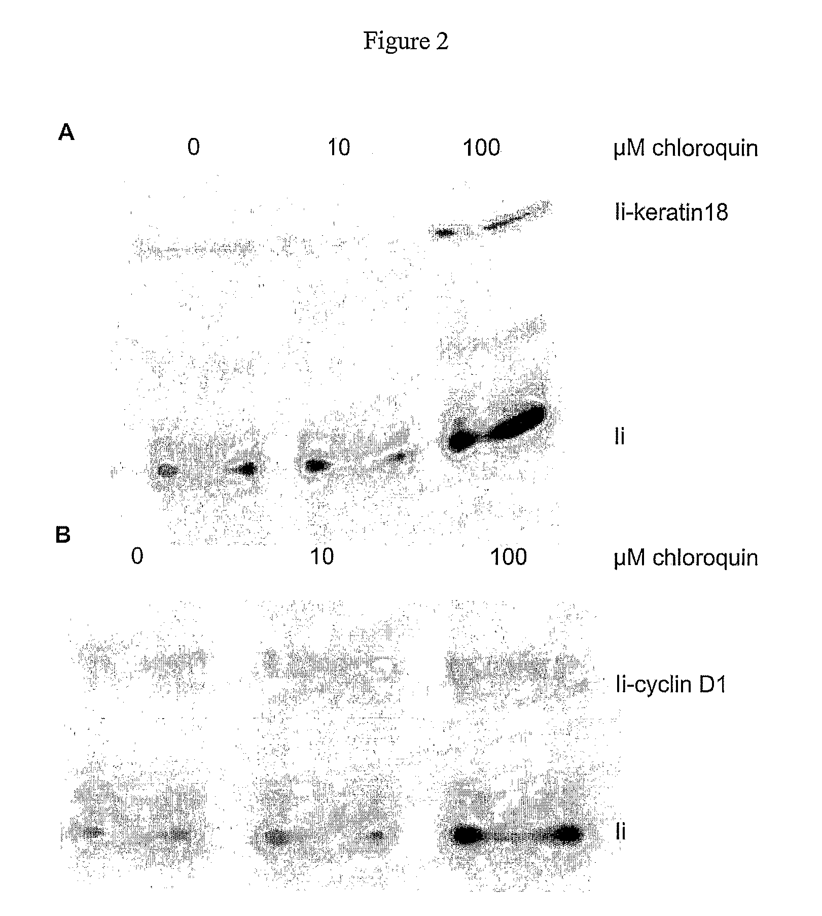 Immunogenic T-helper epitopes from human tumour antigens and immunotherapeutic methods using said epitopes