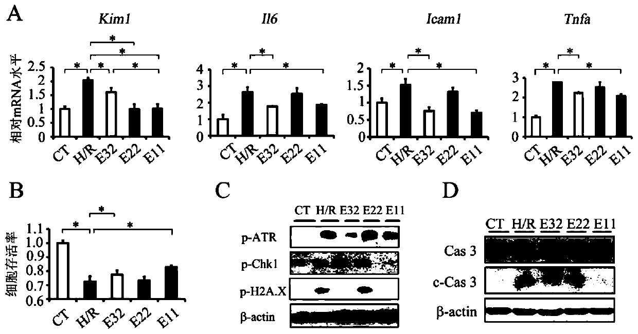 Polypeptide and its application in the treatment of acute kidney injury