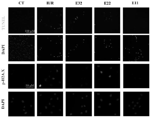 Polypeptide and its application in the treatment of acute kidney injury