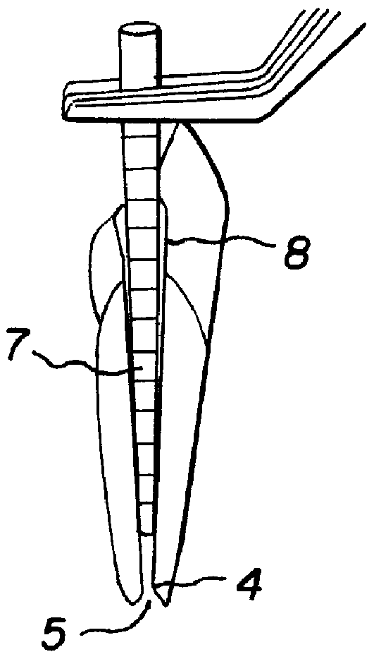 Root canal filling point