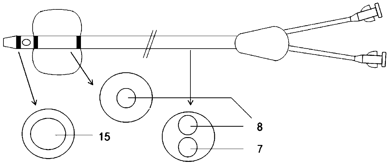 Double-cavity calculus removing balloon