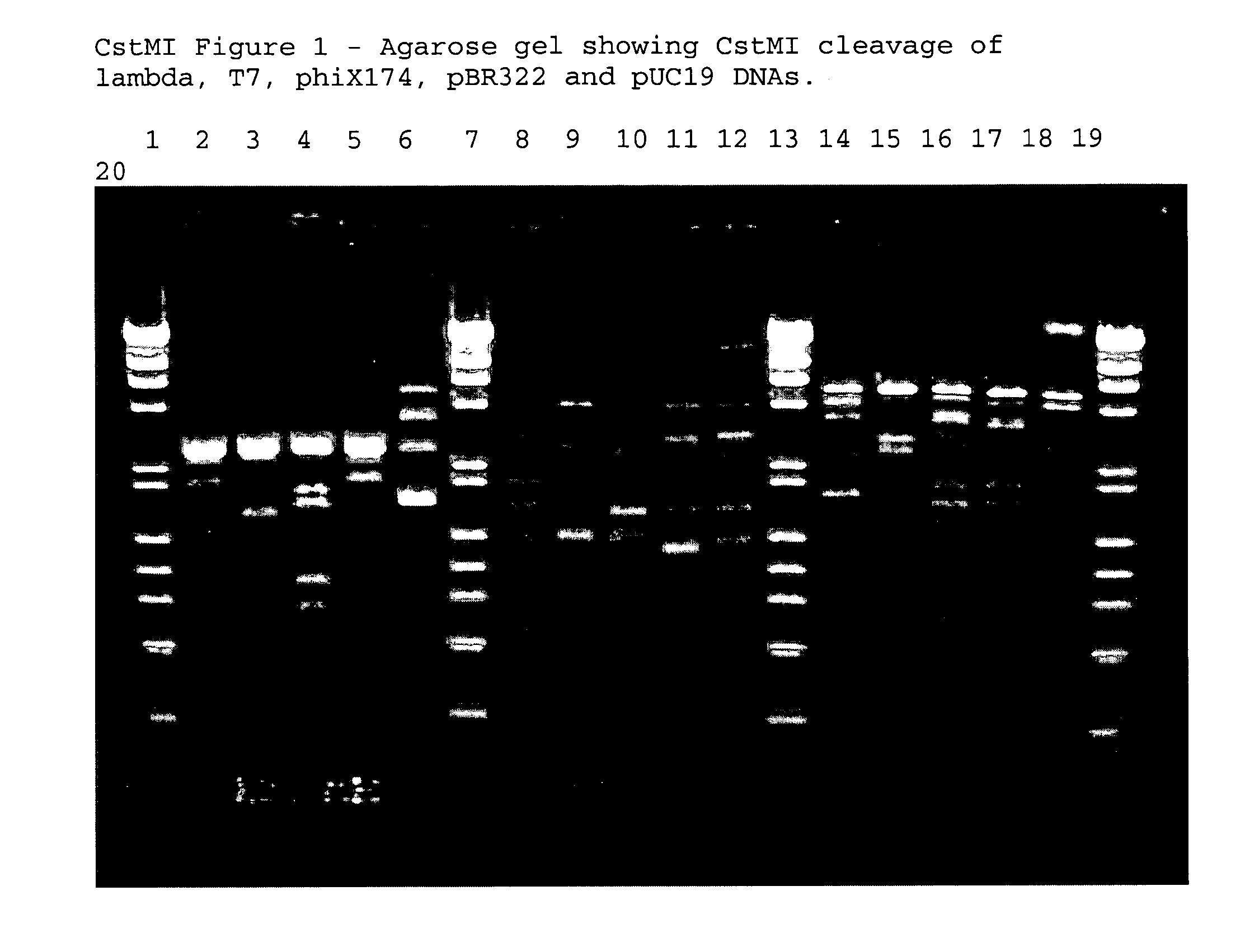 Type II restriction endonuclease, CstMI, obtainable from Corynebacterium striatum M82B and a process for producing the same