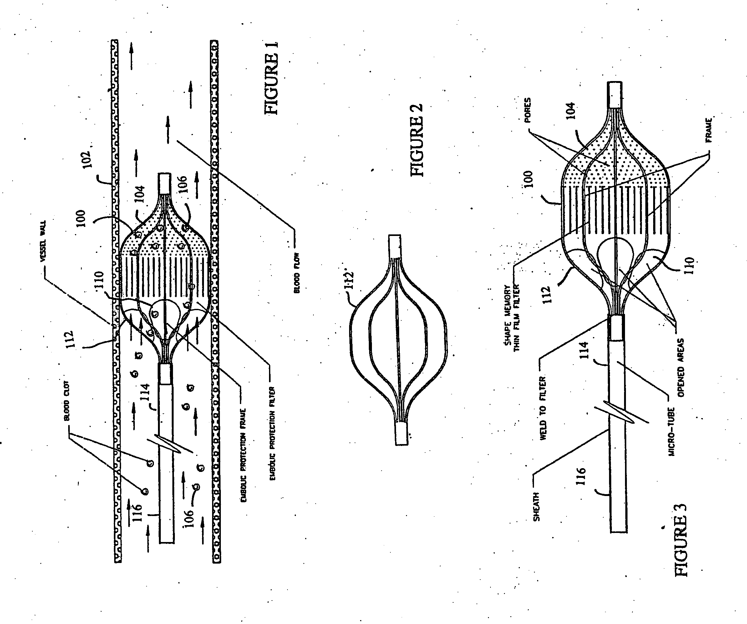 Shape memory thin film embolic protection device with frame