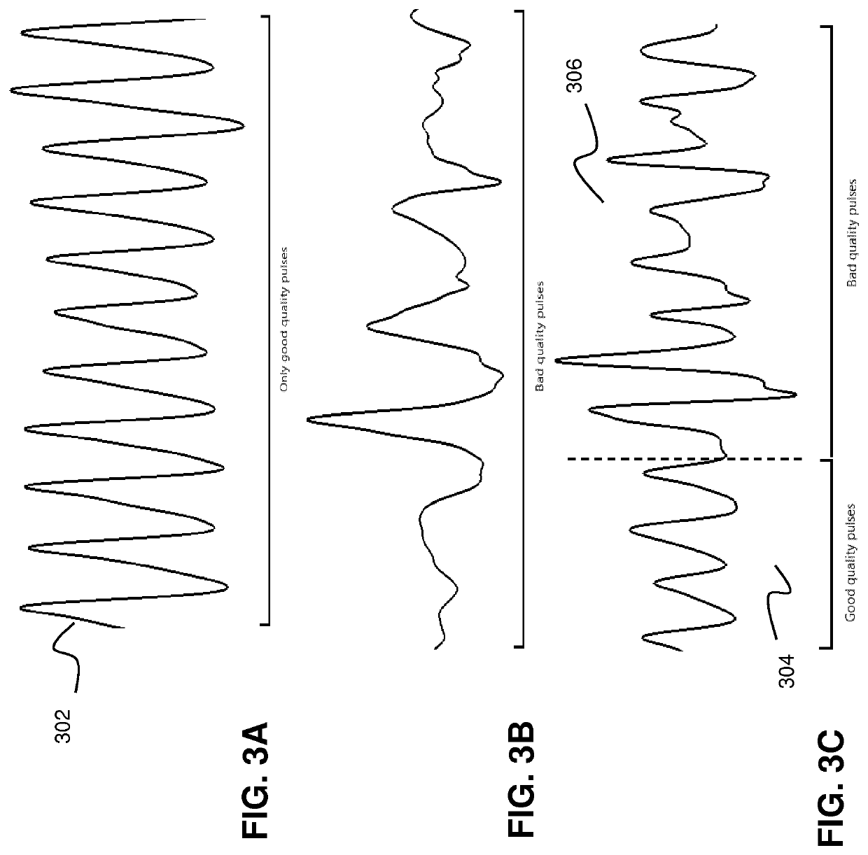 Wireless vital sign monitoring