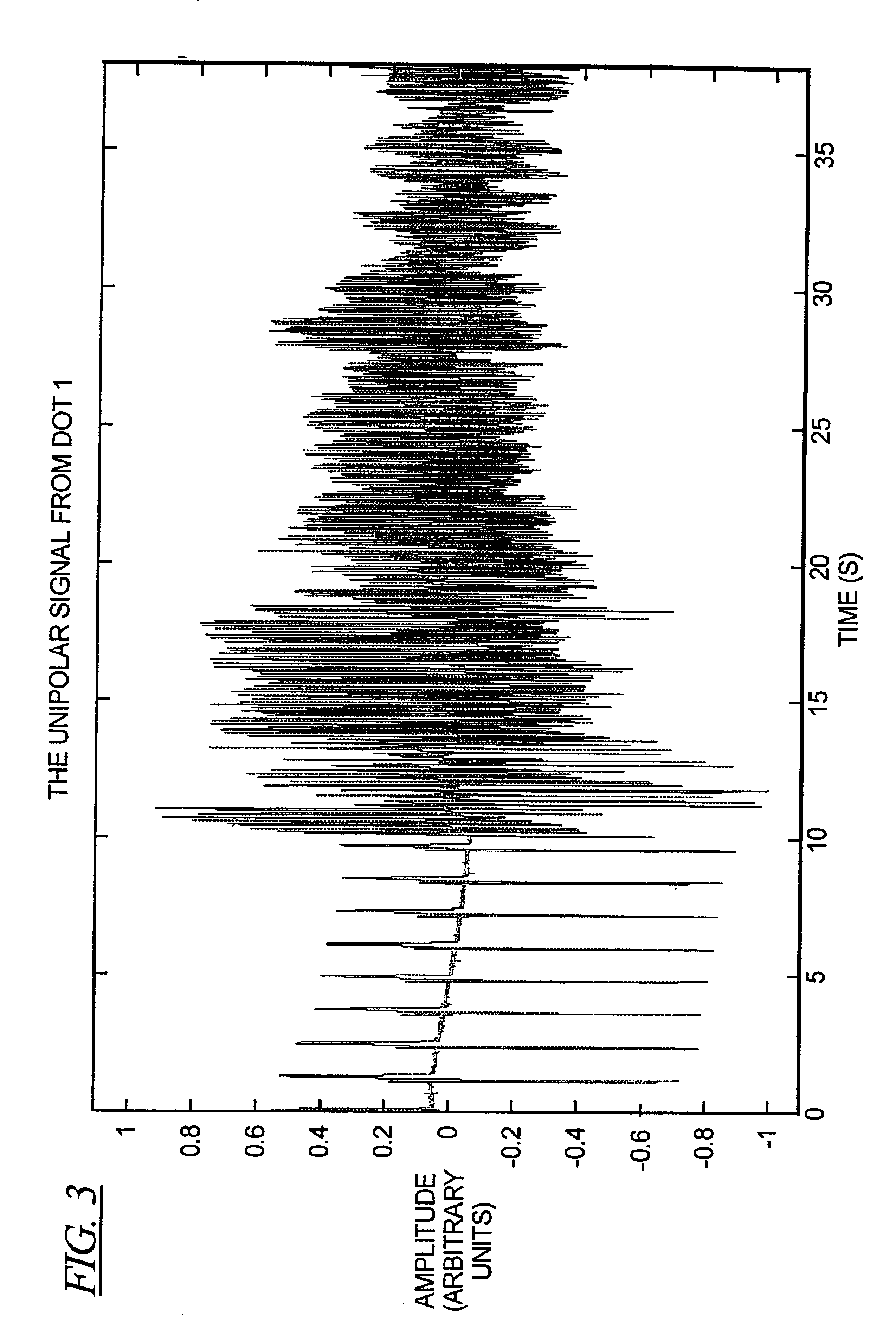 Method and circuit for detecting cardiac rhythm abnormalities by analyzing time differences between unipolar signals from a lead with a multi-electrode tip