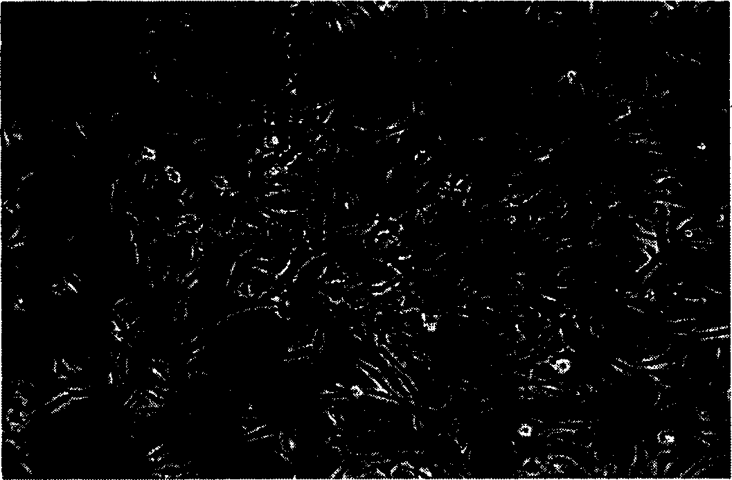 Method for separating mesenchy mall stem/ancestral cells for bone parenchyma