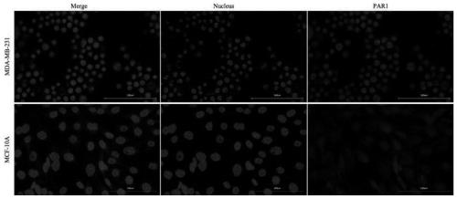 Molecular structure and synthesis method of new triple negative breast cancer drug