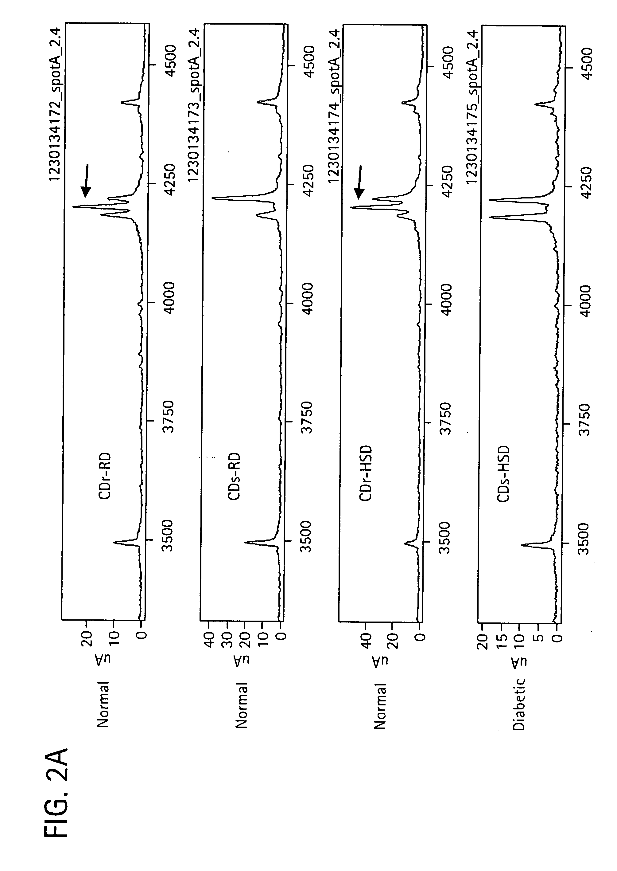 Compositions and methods for diagnosis and treatment  for type 2 diabetes