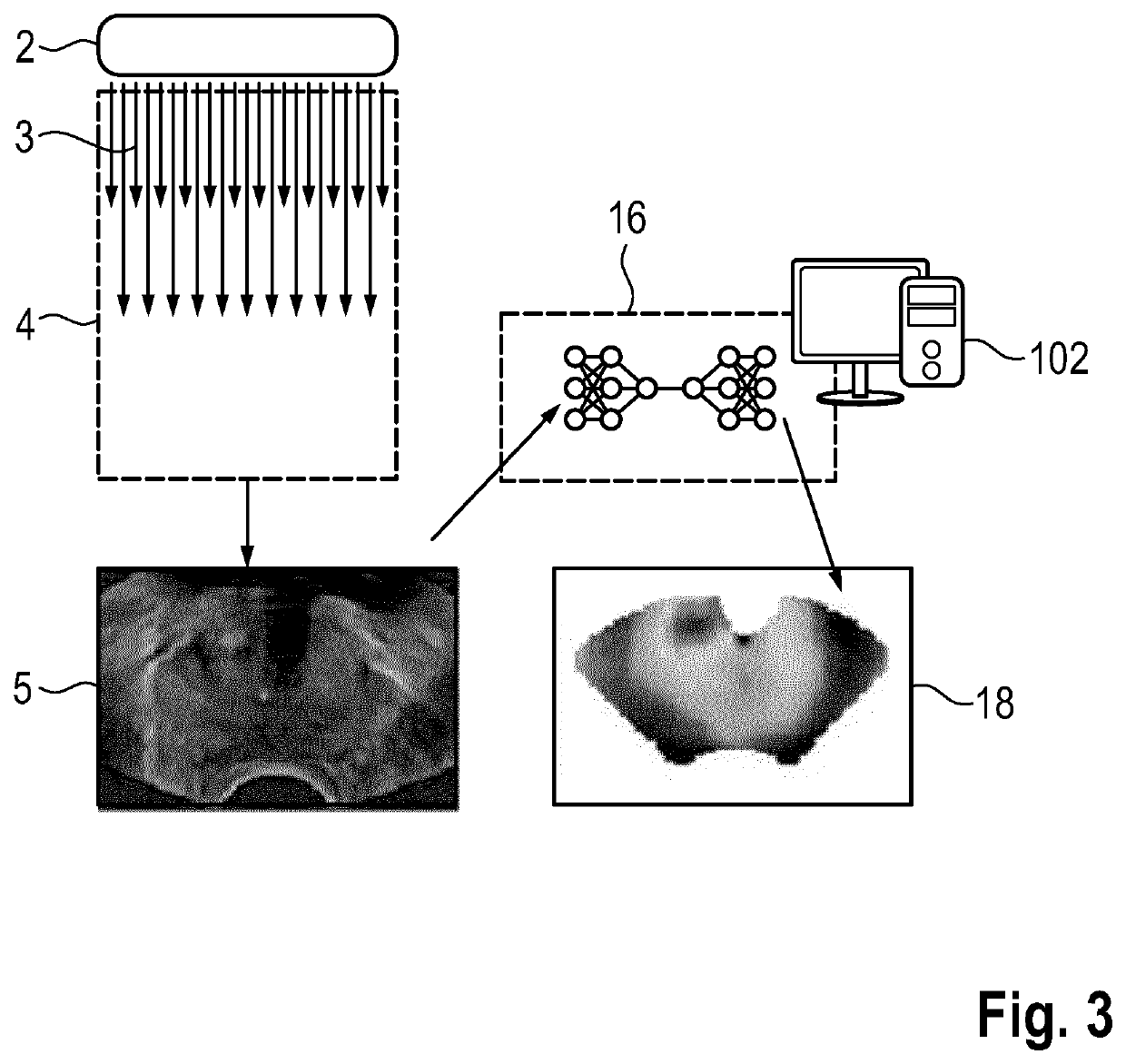 Method and system for generating a synthetic elastrography image