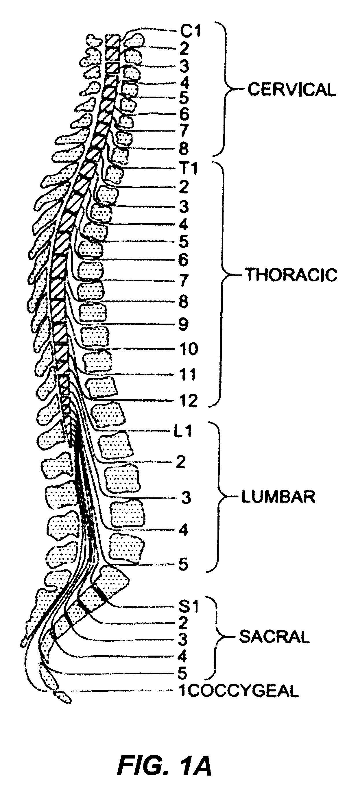 Implantable lead with flexible paddle electrode array