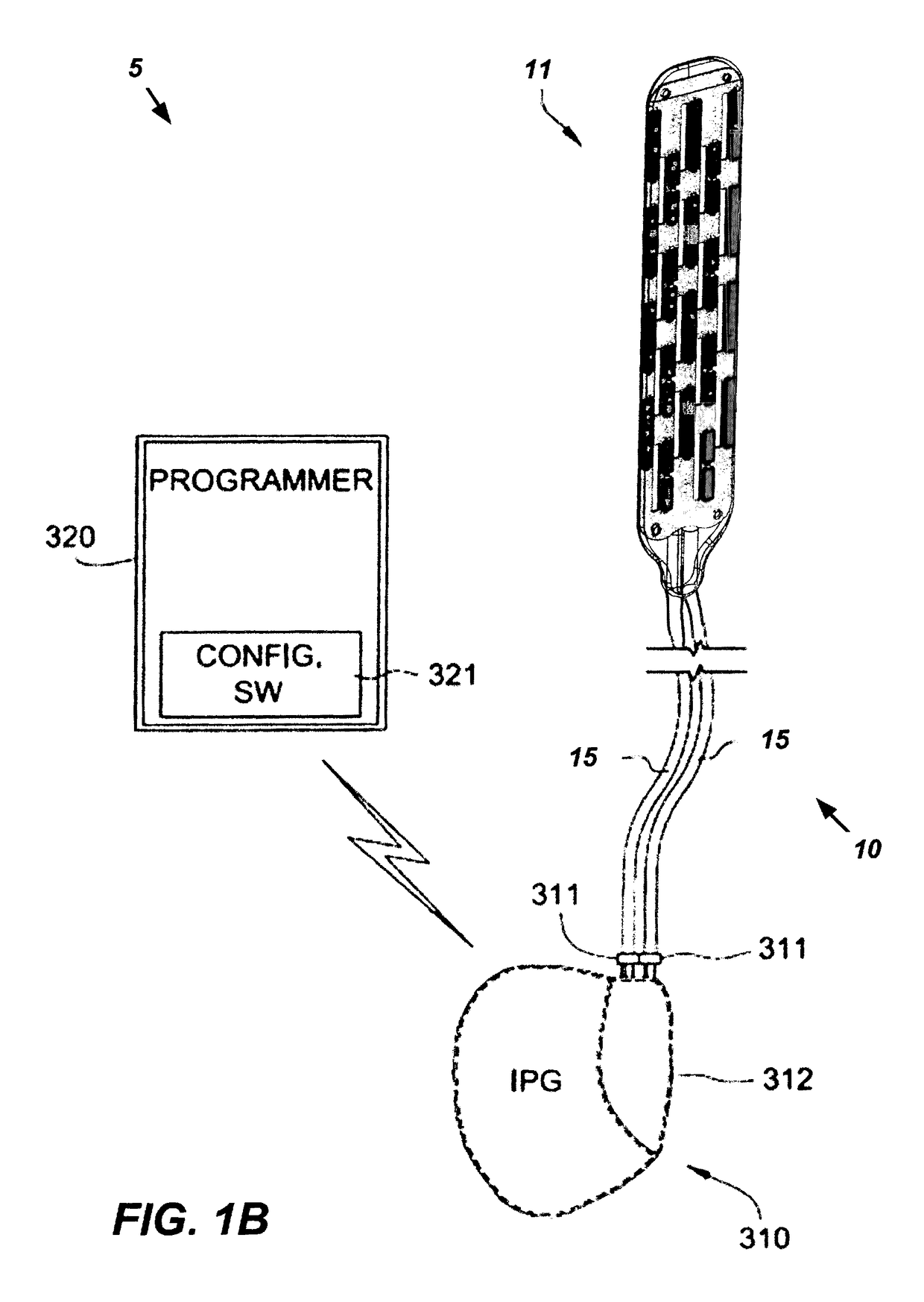 Implantable lead with flexible paddle electrode array