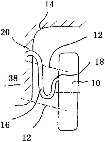 Electrical drive unit for a motor vehicle