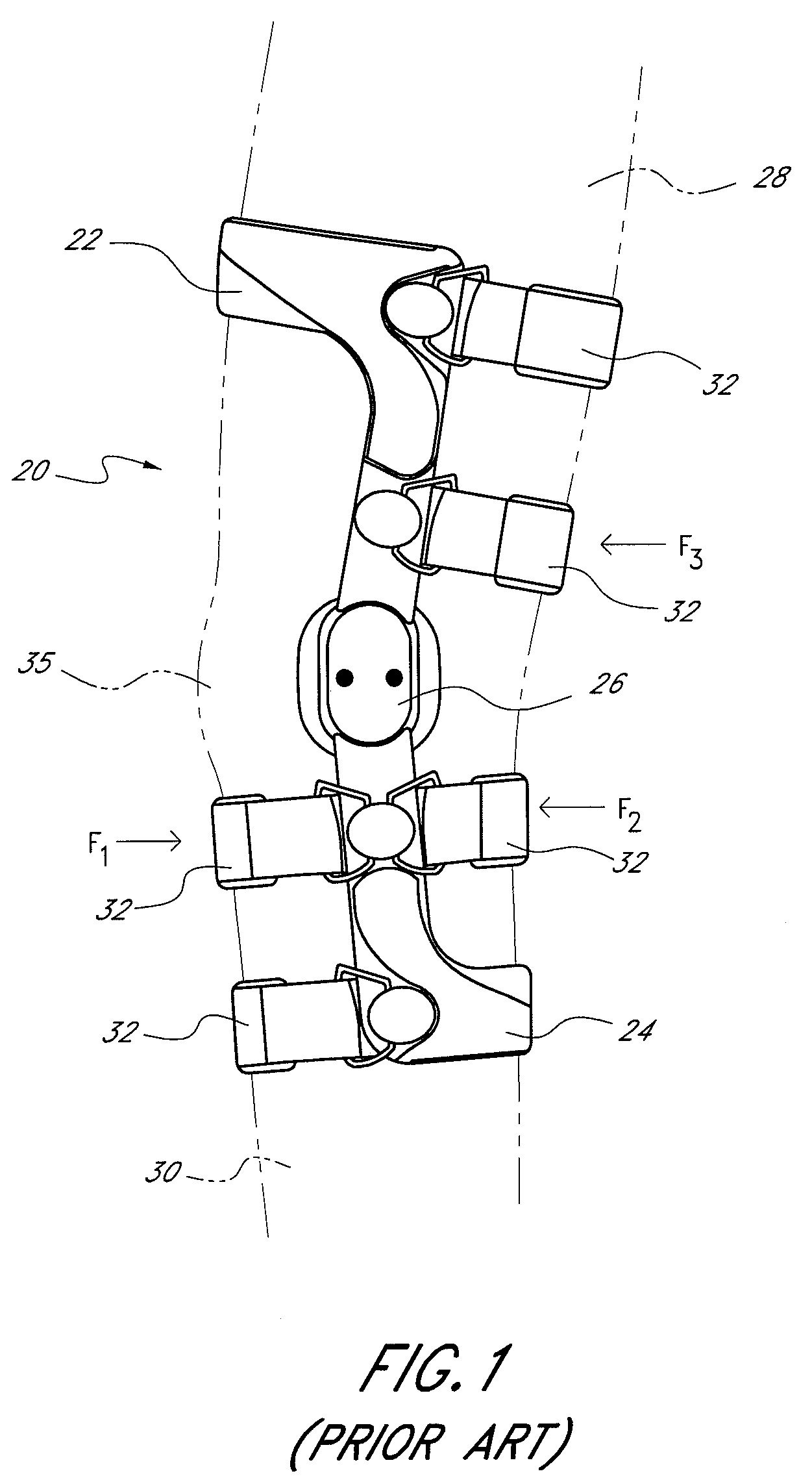 Strap tension indicator for orthopedic brace