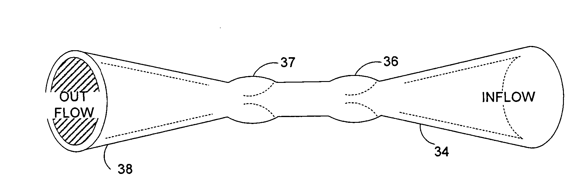 Venous valve prosthesis and method of fabrication