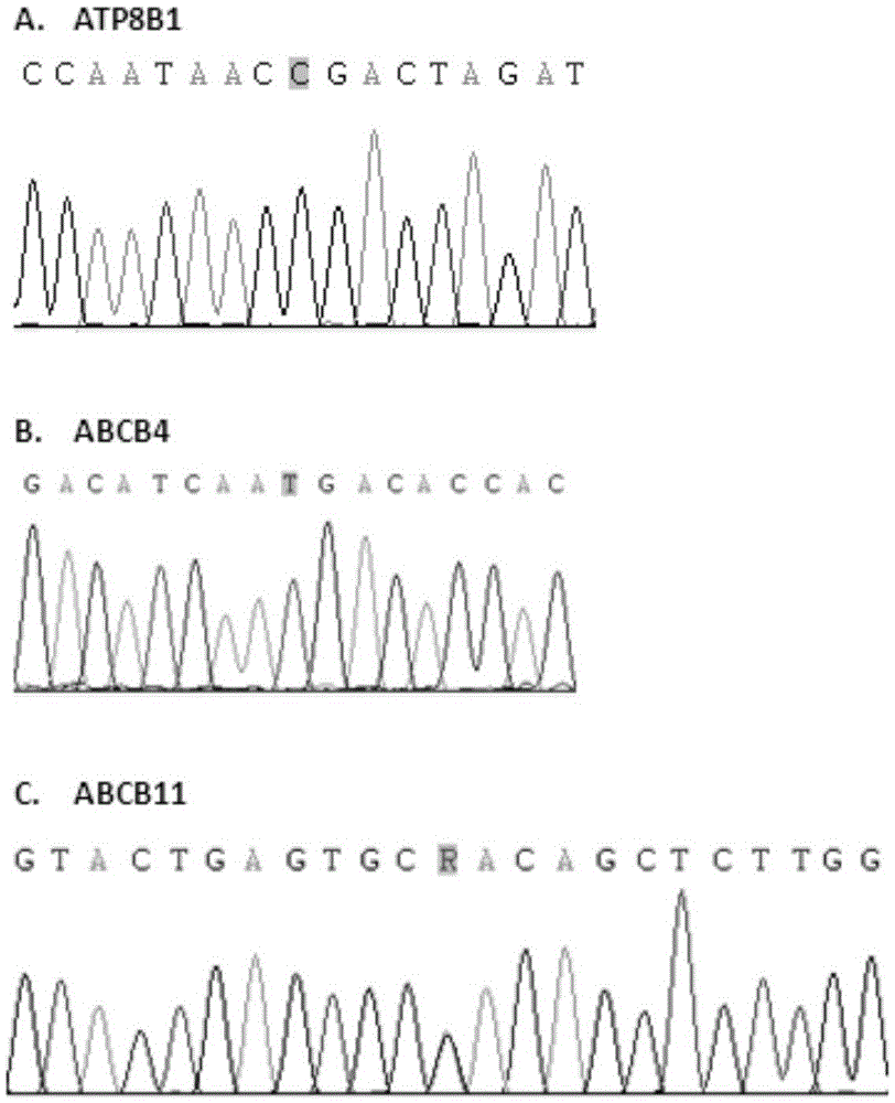 Kit for detecting gene mutation of progressive familial intrahepatic choleatasia (PFIC) and detection method of kit