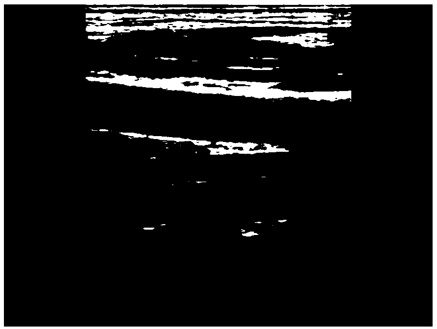 Medical ultrasonic method, system and device for automatically tracking carotid artery