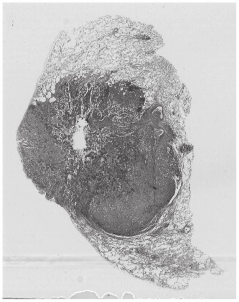 Tissue pathology image cell nucleus segmentation method and system based on polar coordinate representation