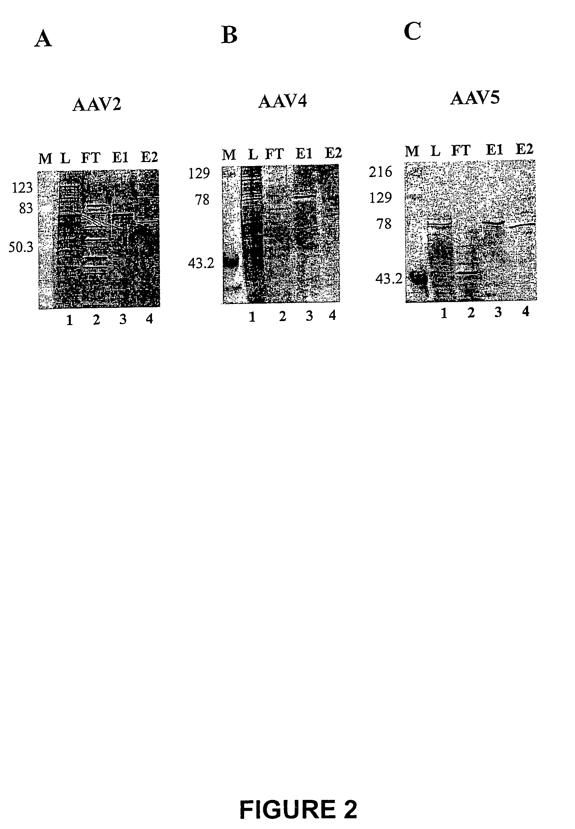 Scalable purification of AAV2, AAV4 or AAV5 using ion-exchange chromatography