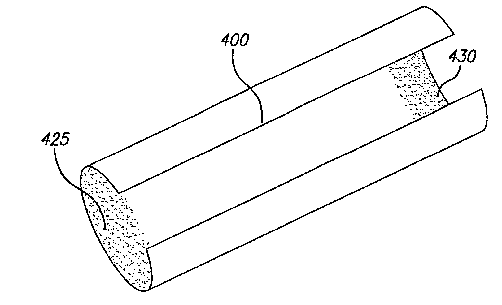 System and method for improved stent retention