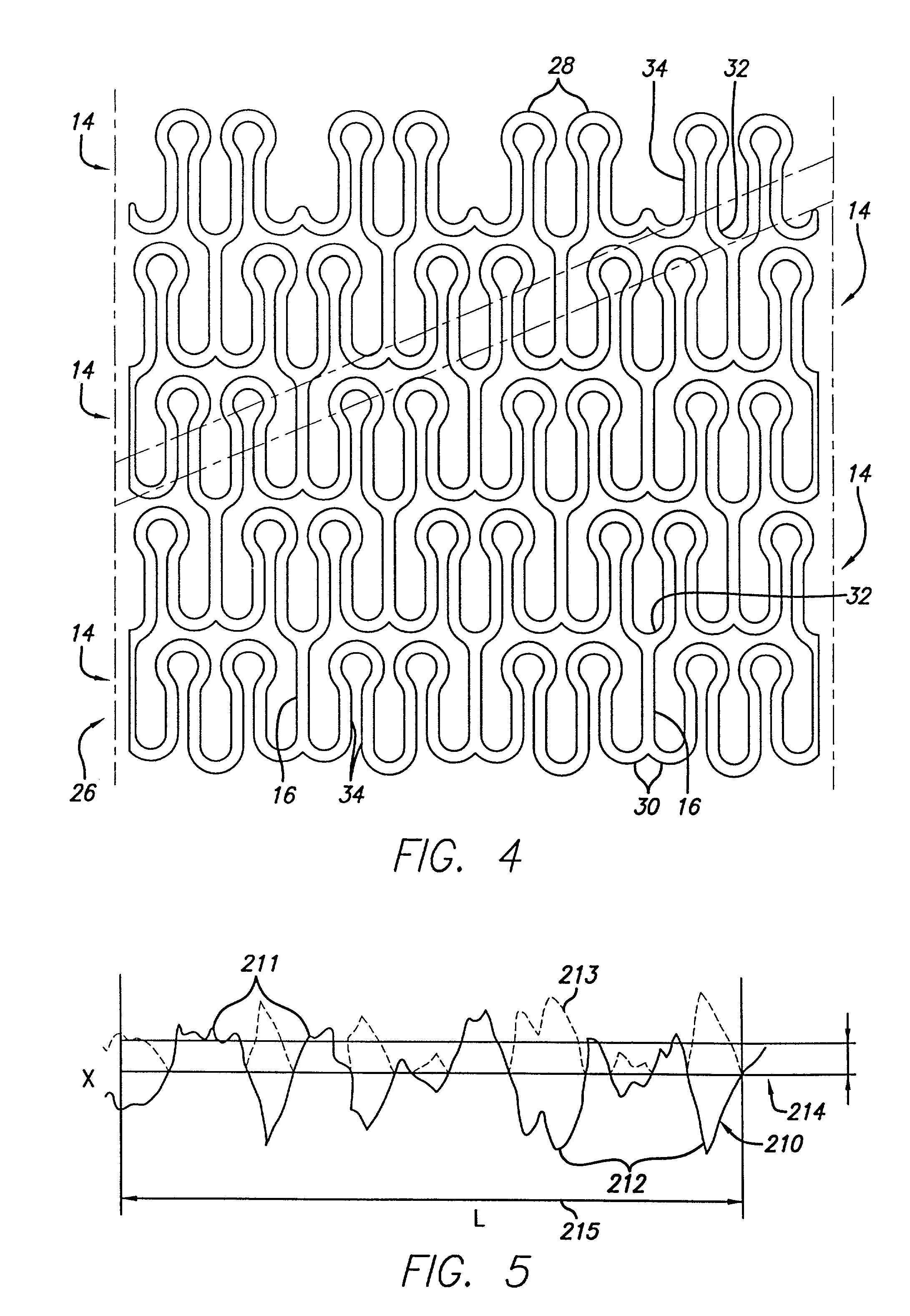 System and method for improved stent retention