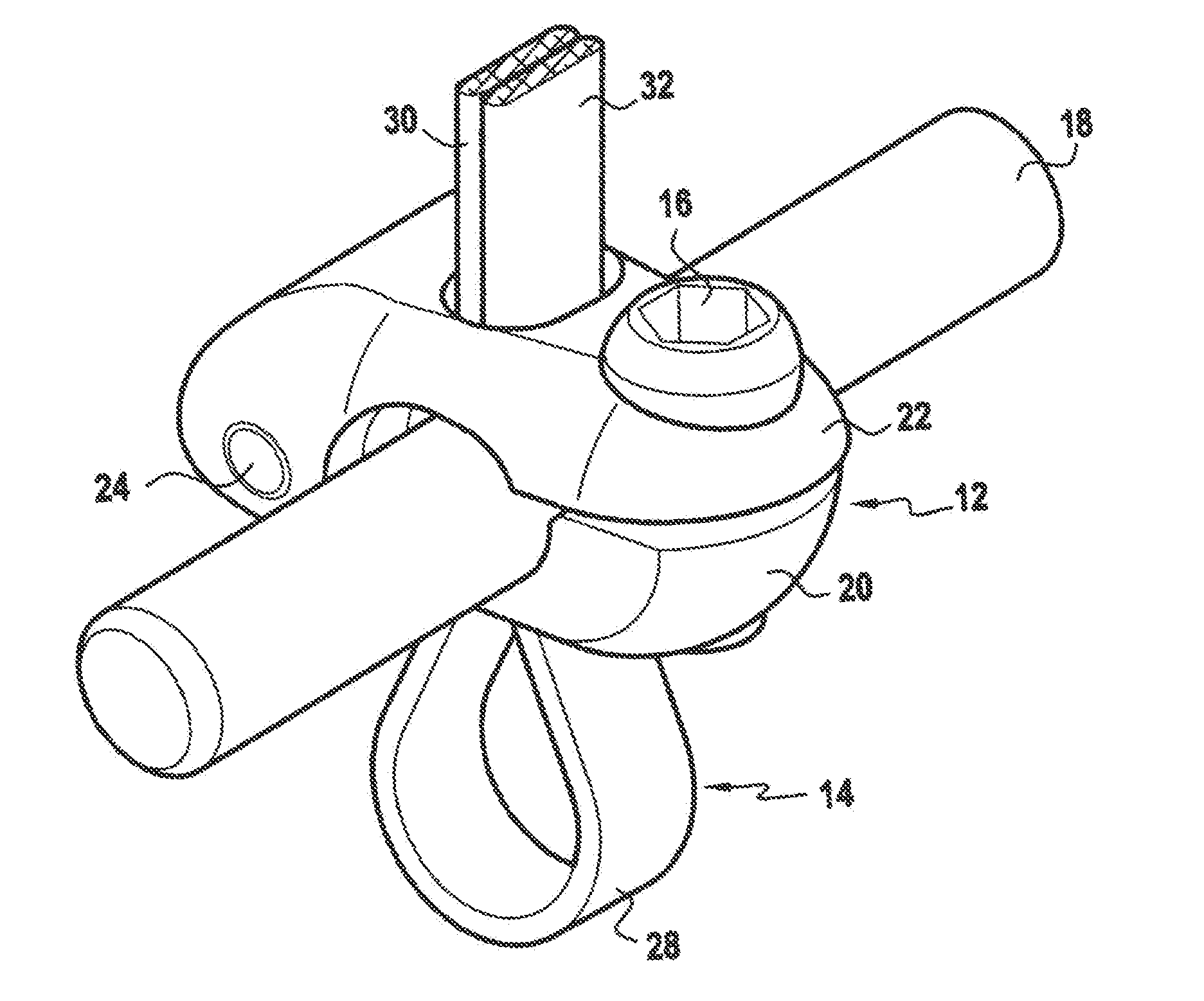 Spinal implant with flexible tie