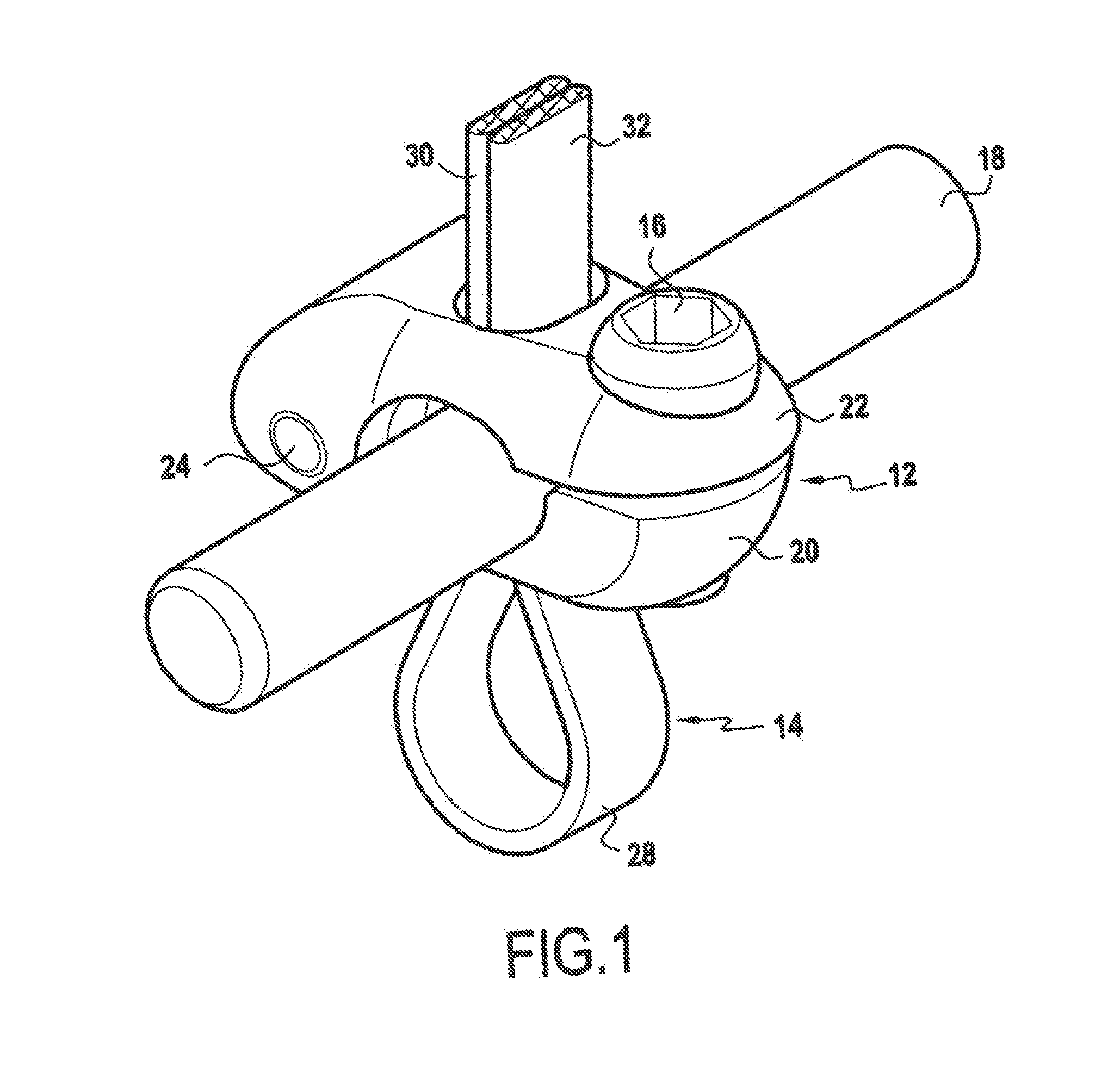 Spinal implant with flexible tie