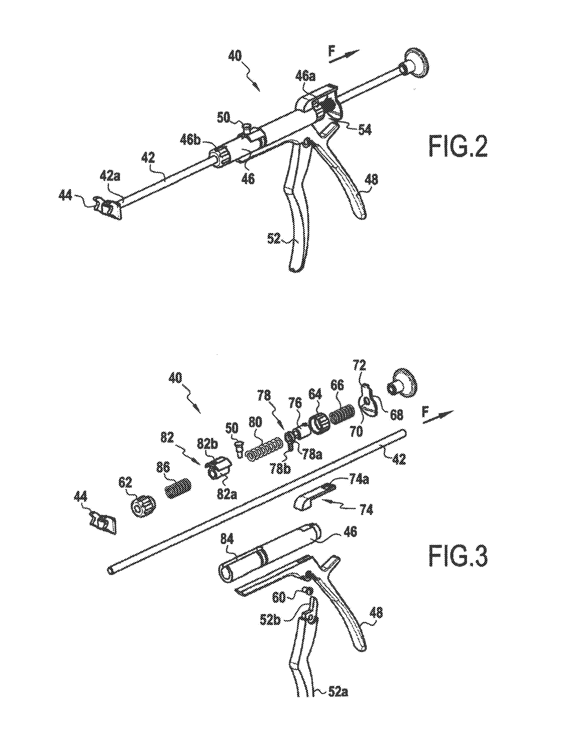 Spinal implant with flexible tie