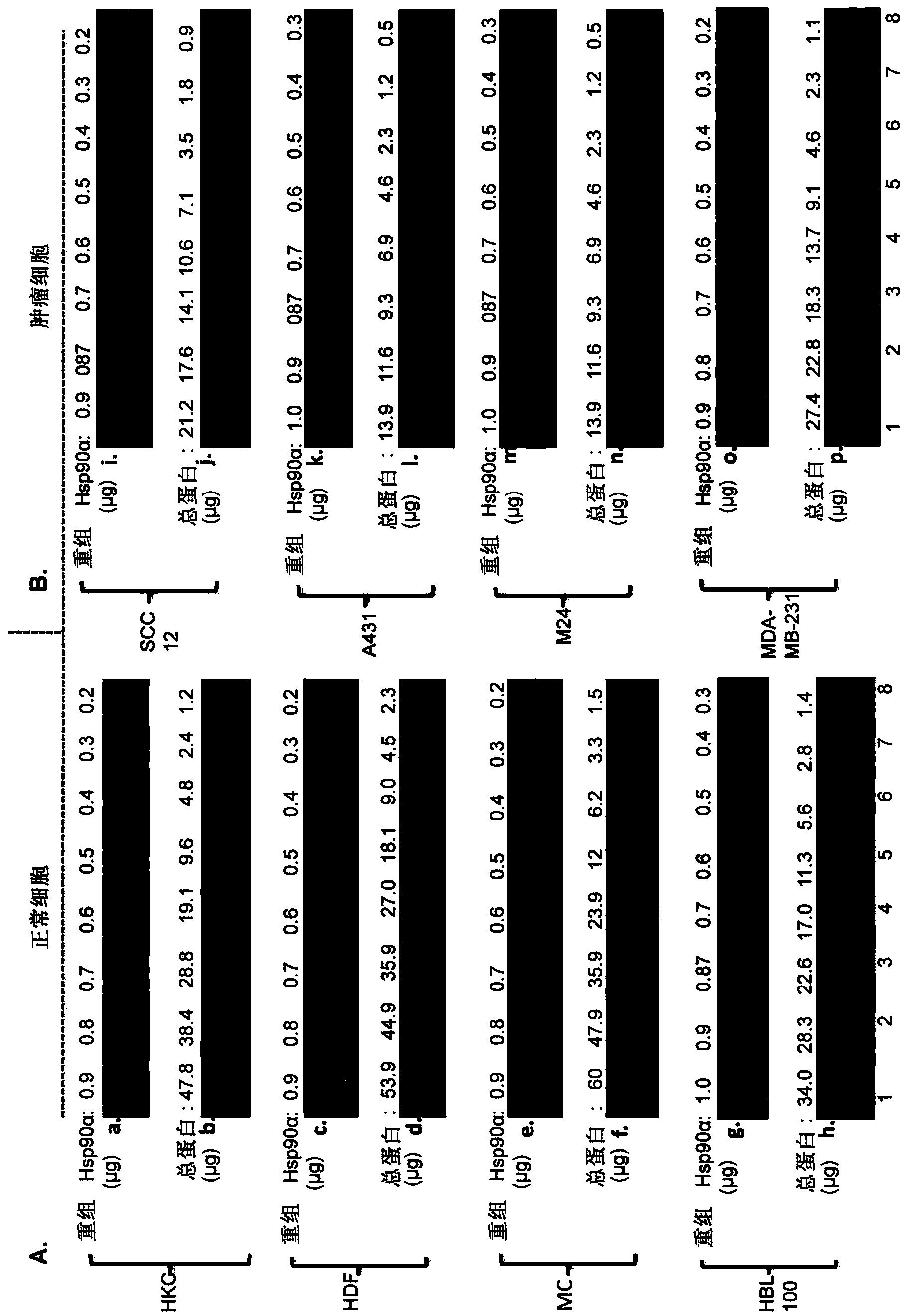 Fragment of secreted heat shock protein-90alpha (Hsp90alpha) as vaccines or epitope for monoclonal antibody drugs or target for small molecule drugs against a range of solid human tumors