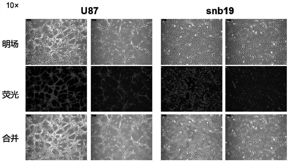 Application of methionine enzyme gene therapy in treatment of malignant tumors