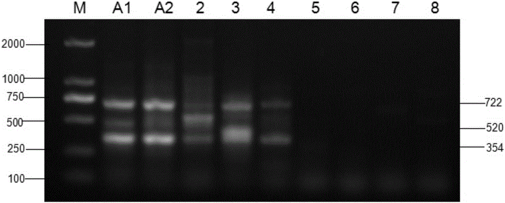 Detection kit for Yersinia rohdei causing enterocolitis and detection method