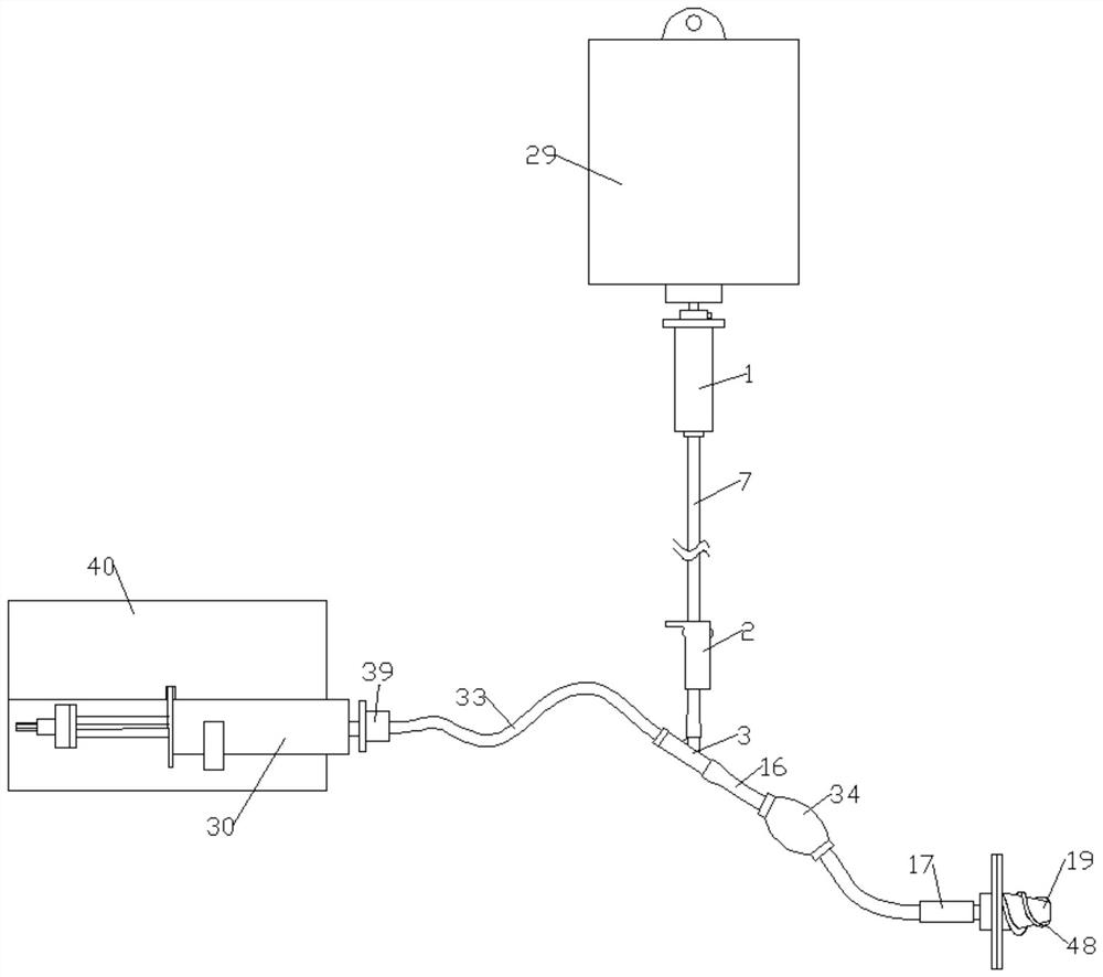 An improved irrigation syringe