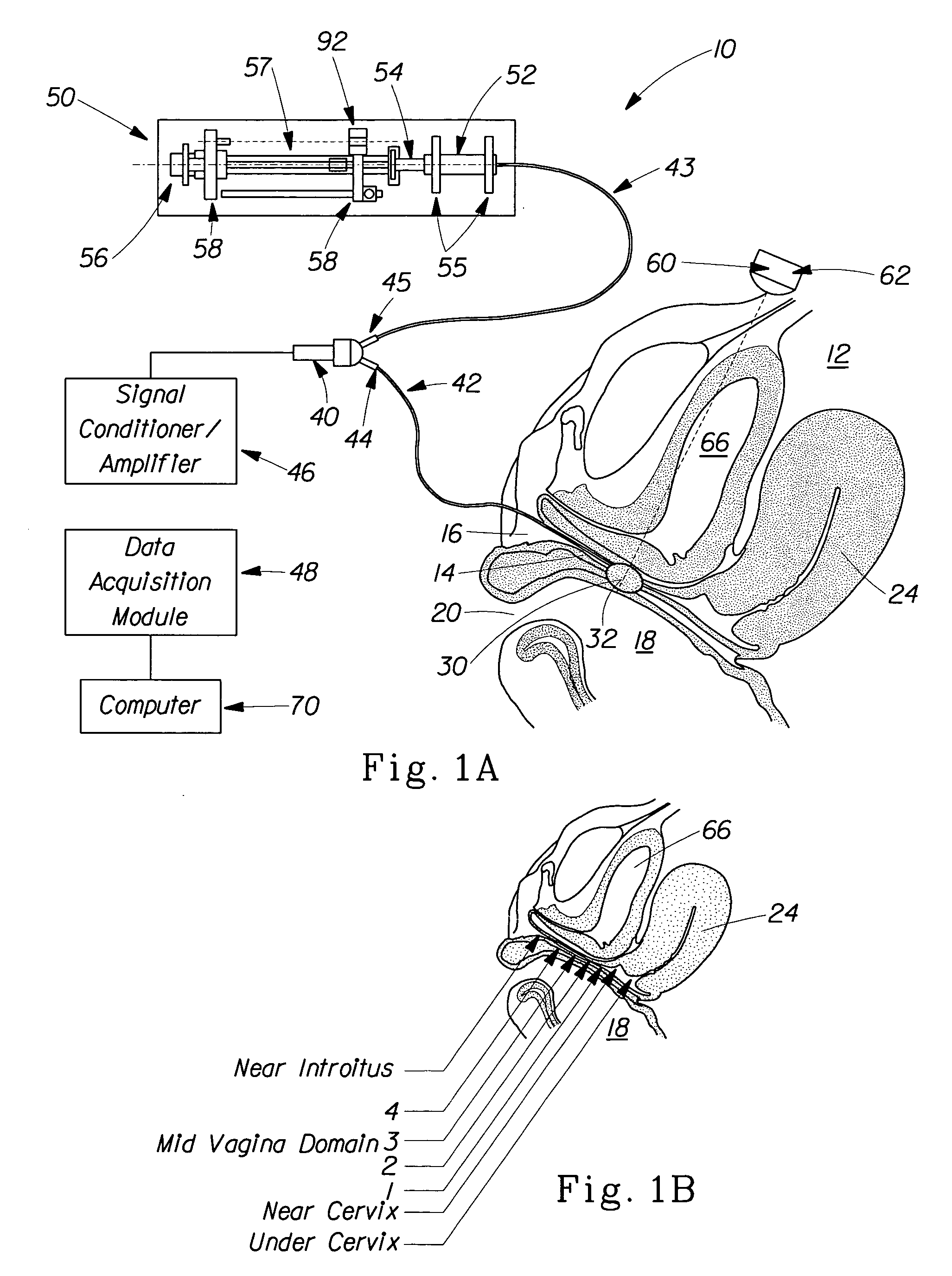 Reverse finite element analysis and modeling of biomechanical properties of internal tissues